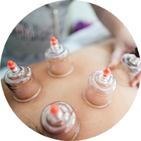 cupping-smaller