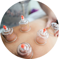 cupping-smaller